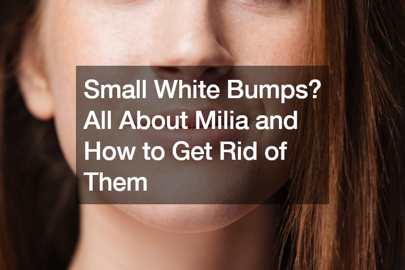 Small White Bumps? All About Milia and How to Get Rid of Them